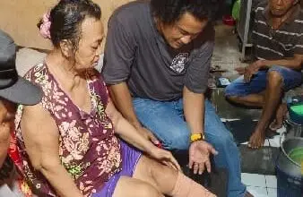 Potongan Kaki di Marina Milik Pasien Diabetes
